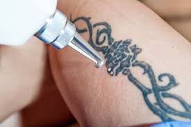Maybe you would like to learn more about one of these? Can Tattoos Be Removed Completely Face Of Man