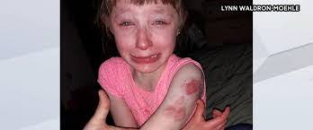 Lilly Waldron's Instagram, Twitter & Facebook