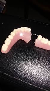Maybe you would like to learn more about one of these? Gigi Palsu Anda Patah Makmal Gigi Palsu Denture Pro Facebook