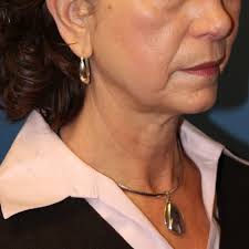 TOP 10 BEST Vision Therapy in Mount Vernon, WA