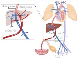 Image result for Delayed Transition from Fetal Circulation