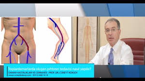 Prof Dr Cuneyt Koksoy Toplardamarlarda Olusan Pihtinin Tedavisi Nasil Yapilir Youtube