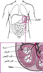 Want to learn more about it? Ù„Ù…Ø­Ø© Ø¹Ø§Ù…Ø© Ø¹Ù† Ø§Ù„Ø·Ø­Ø§Ù„ Ø§Ø¶Ø·Ø±Ø§Ø¨Ø§Øª Ø§Ù„Ø¯ Ù… Ø¯Ù„ÙŠÙ„ Msd Ø§Ù„Ø¥Ø±Ø´Ø§Ø¯ÙŠ Ø¥ØµØ¯Ø§Ø± Ø§Ù„Ù… Ø³ØªØ®Ø¯ Ù…