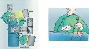 Image result for Sinus Surgery