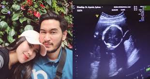 Foto hasil usg janin itupun viral setelah dibagikan akun twitter @madoka_people. Syahnaz Hamil Anak Kembar Perempuan Dan Laki Laki Popmama Com