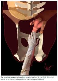 A I Technique In Cattle Animal Science Dairy Cattle Cattle