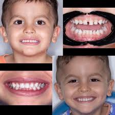 Dra. Iris Acevedo Odontologo