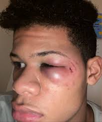 CAIR-NJ: Victims of Paterson Police Brutality Incidents, Attorneys,  Community Leaders to Speak at Virtual News Conference