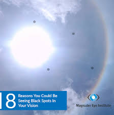 Black Spots In Vision Seeing Black Spots Spots In Eyes Black Spot