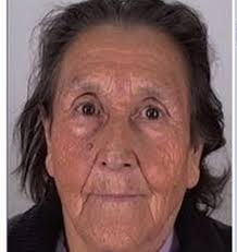 Angustia en Fresia por adulta mayor perdida hace un mes