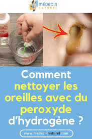 Voici Une Astuce Facile Pour Nettoyer Vos Oreilles Oreille Nettoyer Peroxyde Remede Naturel