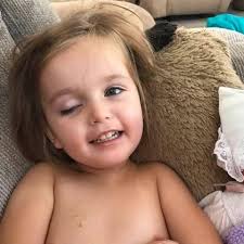 Beautiful Ella has passed away after fighting DIPG for 10 months. She was 4  years old. Ella was sweet, sassy, and spunky. She loved dolls, princesses,  and animals of all sorts. She