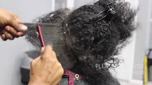 How do you get rid of flakes in hair? Picking Big Scalp Flakes Psoriasis And Dermatitis Sew In Removal Video Https Blackhairinformation Com Video Gallery P Scalp Diseases Dermatitis Psoriasis