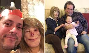 Woman whose face was burned off in house blaze reveals she has found love