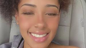 Young woman hit by two cars in North Texas