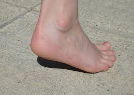 We did not find results for: Causes Of Cracked Heels How To Deal With Heel Fissures Hubpages