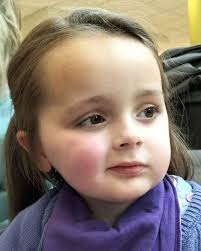 This beautiful little girl is Aria Hodgkiss. At the age of just four years  old, she has terminal brain cancer. The location of her tumour means it  can't be operated