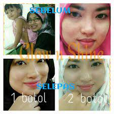 Flavettes effervescent glow juga merupakan supplemen tambahan 3 in 1. Glow Shine Vitamin C Rosehip 1000mg Photos Facebook