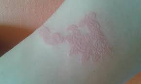 Wann ist es jugendlichen erlaubt, sich tätowieren zu lassen und was müssen sie, ihre eltern und der tätowierer beachten? Hallo Hab Mir Ein Henna Tattoo Machen Lassen Ich Bin Total Ellergisch Jucken Ausschlag Pickel Schwellung Bleiben Narben Was Dagegen Tun Habsalbe Allergie Henna Tattoo