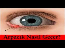 Gozdeki Arpacik Neden Cikar Dogal Cozumler Youtube