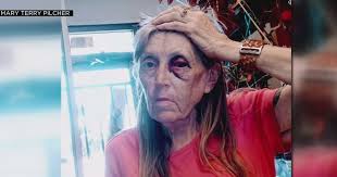 Elderly Small Business Owner Allegedly Beaten With Metal Pole By Woman