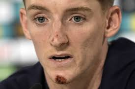 England winger Gordon escapes serious injury from bike accident during  downtime at Euro 2024