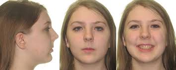 SAO News Spring 2023 by Southern Society of Orthodontists