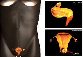 Una vez que el médico ha diagnosticado la presencia de una masa tumoral en el cuello del útero de la mujer. Cancer Cervical Cancerquest