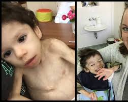 Mirti paliktas vaikas atrodo neatpažįstamai