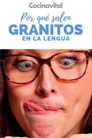Por Que Salen Los Granitos De La Lengua Sera Un Antojo Granito Lengua Salud Y Belleza