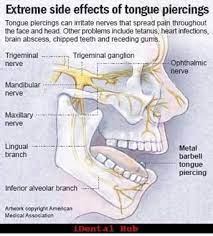 Piercings Can Have Damaging Consequences Tots To Teens Pediatric Dentistry T2tpd Com Dental Pediatric Dentistry Dentistry