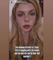 Arielas from 90 Day Arm Scars