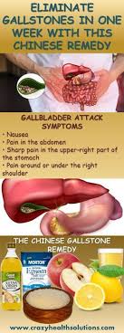 Eliminate Gallstones In One Week With This Chinese Remedy