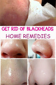 Pin On Health Beauty Tips