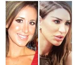 90 day fiance cast plastic surgeries