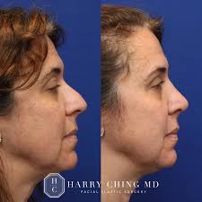 Harry Ching MD (@harrychingmd) • Instagram photos and videos