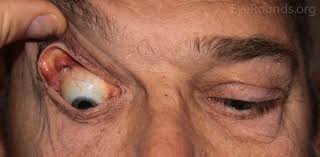 A collection of beats for studying, exploring, and reflecting. Floppy Eyelid Syndrome