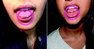 Expédition sous 24h de votre commande. Snake Eyes Le Piercing A La Mode Deconseille Par Tous Les Medecins