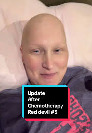 Update after chemotherapy red devil #3 #breastcancer #reddevilchemothe...