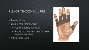 Image result for Hand Extensor Tendon Injury