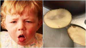 Disusun bersama laura marusinec, md. Menyembuhkan Batuk Pada Bayi Dengan 6 Cara Semulajadi Ini Theasianparent Malaysia