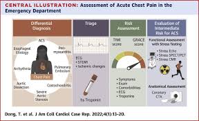 Image result for Chest Pain Observation Unit