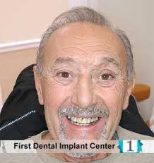 First Dental Implant Center