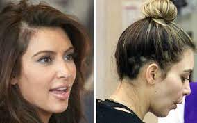 Can any hair loss medication. Oh Nooo 10 Female Celebs Suspected Of Balding Photo Gallery Female Celebrities Hair Hairstyles For Thin Hair Hair Loss Women