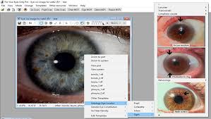 Fyeo Pro Iridology Analysis Scanning And Reporting Software