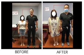 On average, the steady growth of middle childhood results in an increase in height of a little over 2 inches a year in both boys and girls. Height Increase Surgery Bone Lengthening In Hollywood California