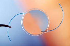 What To Expect With Cataract Surgery Cataract Surgery Cataract Eye Surgeon