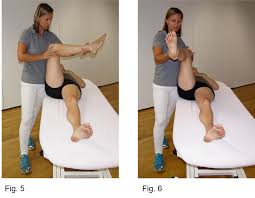 Image result for Femoral Retroversion