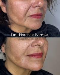 Dra Florencia Barraza