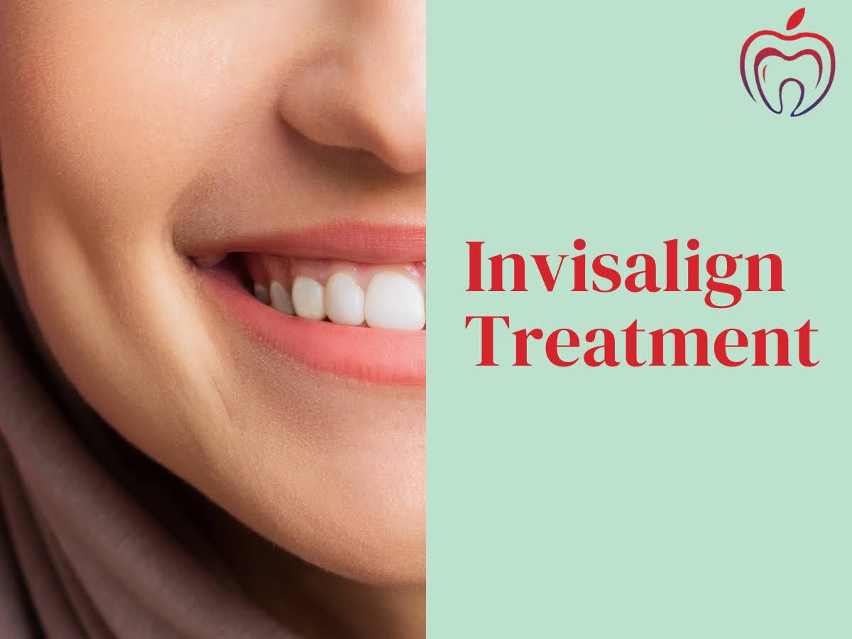 Invisalign Dentist product image